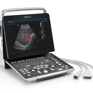 mindray_z60_portables-farbdoppler-ultraschallgeraet_abdomen
